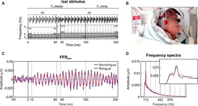 Exposure to bilingual or monolingual maternal speech during pregnancy affects the neurophysiological encoding of speech sounds in neonates differently